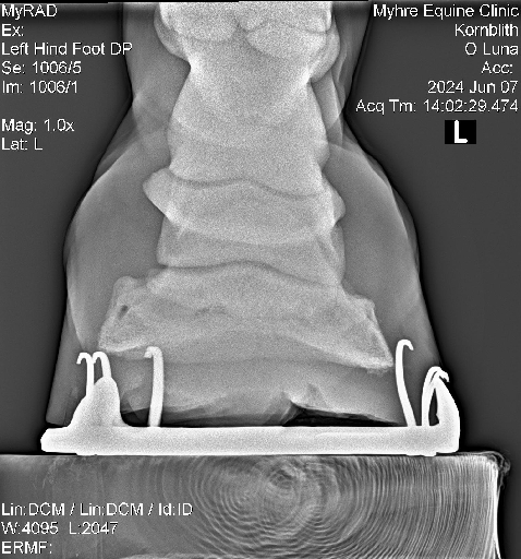 Luna Radiographs0004